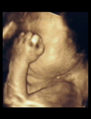 胎児超音波診断画像１